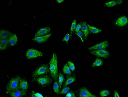 Polyclonal Rabbit anti-Human VR1 / TRPV1 Antibody (IHC, IF)