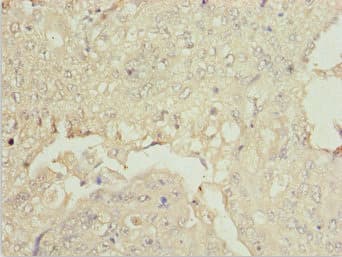 Polyclonal Rabbit anti-Human ZNF187 Antibody (IHC, WB)
