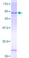 Human DCLRE1C / Artemis Protein (Recombinant GST)