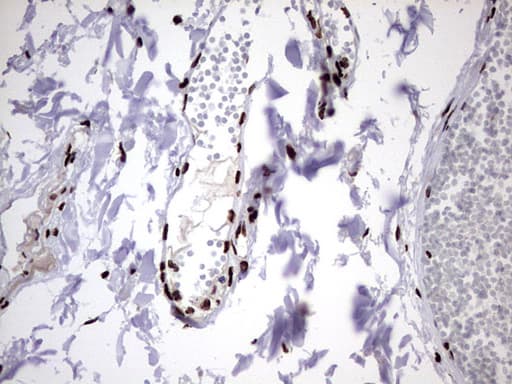 HNRPM / HNRNPM Antibody (aa1-261, clone OTI4C9)