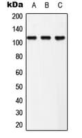 EPHB3 / EPH Receptor B3 Antibody (phospho-Tyr608)