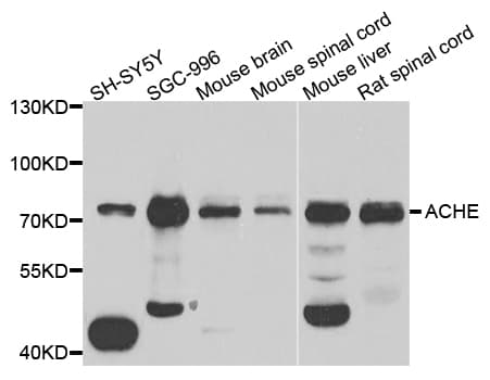 PathPlus™ Polyclonal Rabbit anti-Human ACHE / Acetylcholinesterase Antibody (IHC, WB)