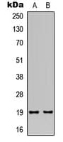 TUSC5 Antibody (N-Terminus)
