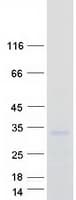 Human PDCD10 Protein (Recombinant Myc-DDK (Flag))
