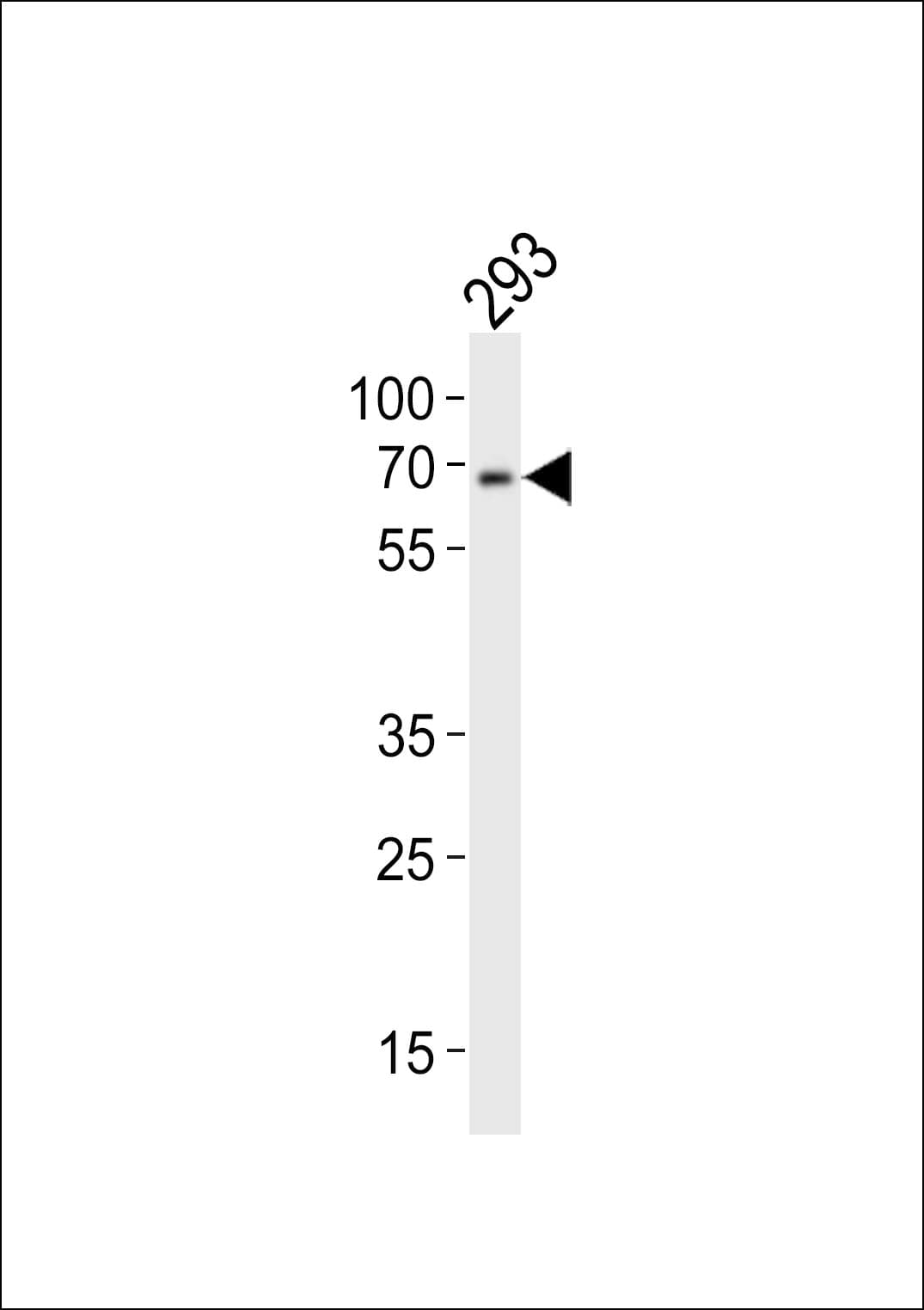 DYRK2 Antibody (aa105-135)