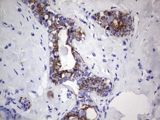 Acidic Cytokeratin Antibody (clone 8A3)