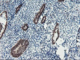 TPRKB Antibody (clone OTI3H3)