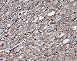 CD36 Antibody (clone OTI6A5)