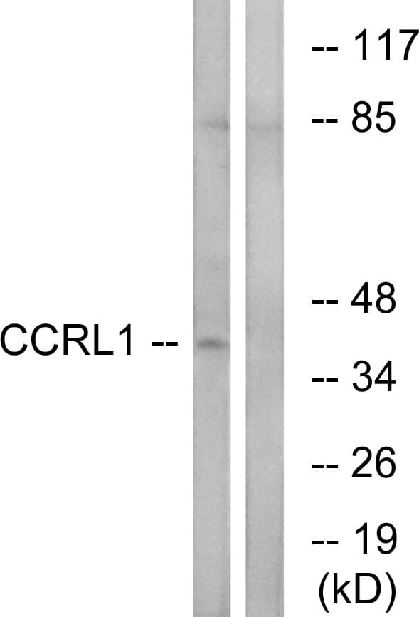 ACKR4 / CCRL1 / CCR11 Antibody (aa291-340)