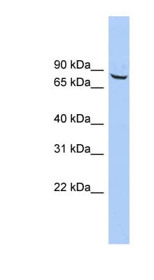 Polyclonal Rabbit anti-Human ACCN4 / ASIC4 Antibody (aa484-533, WB)