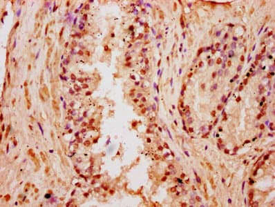 HIST1H3A Antibody
