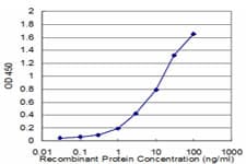 Monoclonal Mouse anti-Human CTH / Cystathionase Antibody (clone 4E1-1B7, WB)