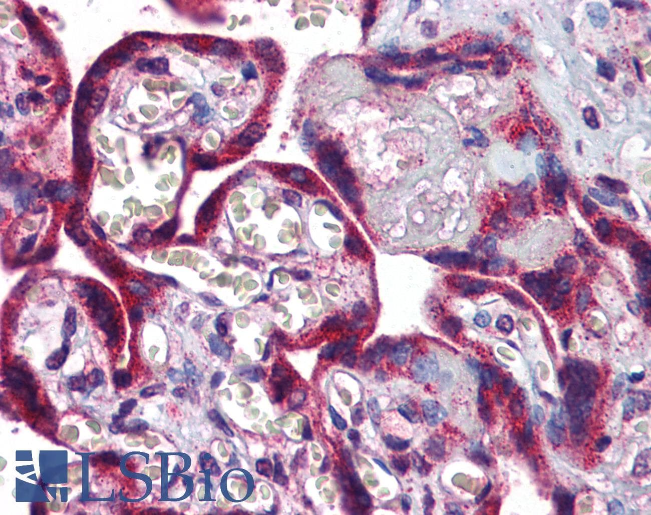 LTA4H / LTA4 Antibody (aa467-516)