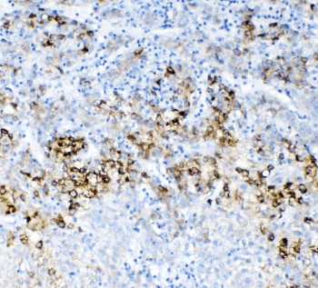 Polyclonal Rabbit anti-Human ABCC2 / MRP2 Antibody (IHC, WB)