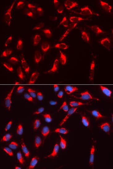WASL / N-WASP Antibody
