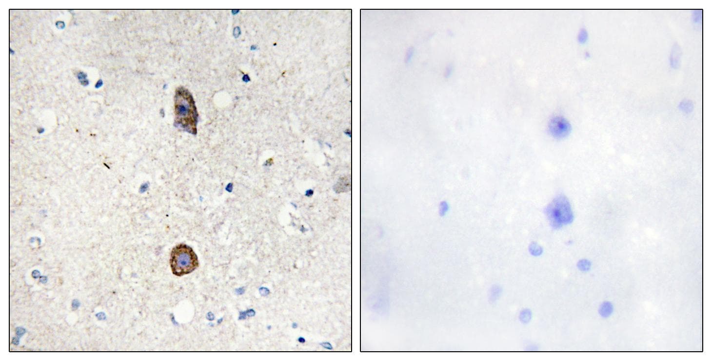 IGFBP3 Antibody (phospho-Ser183)