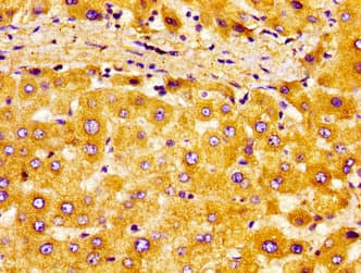 EAR2 / NR2F6 Antibody