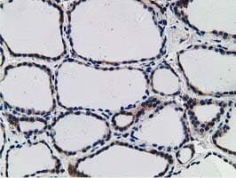 IHC-plus™ SNX8 Antibody (clone 4F8)