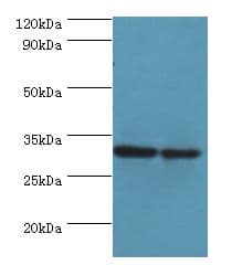 PNP / Nucleoside Phosphorylase Antibody (aa1-289)