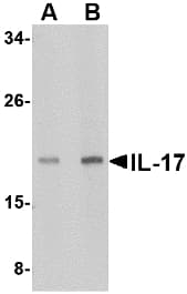 IL17A Antibody