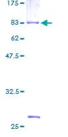 Human RAP1GDS1 / SmgGDS Protein (Recombinant GST)
