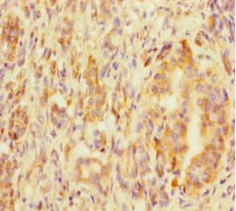 Polyclonal Rabbit anti-Human MED20 Antibody (IHC, IF)