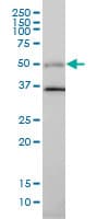 Monoclonal Mouse anti-Human ARA55 / HIC-5 Antibody (clone 4B2-D8, WB)