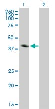CA12 / Carbonic Anhydrase XII Antibody (clone 1D4)