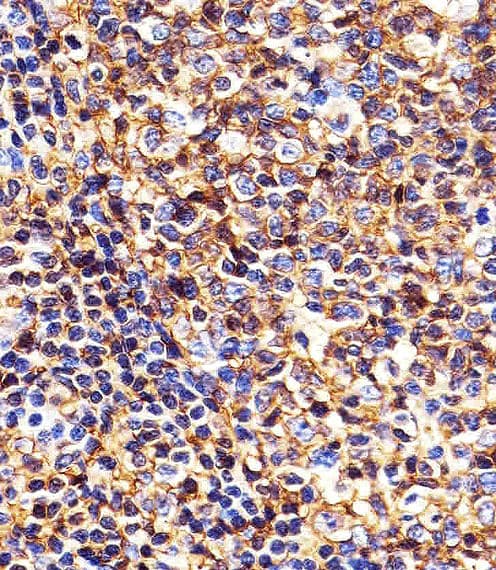 HLA-B Antibody (N-Terminus)