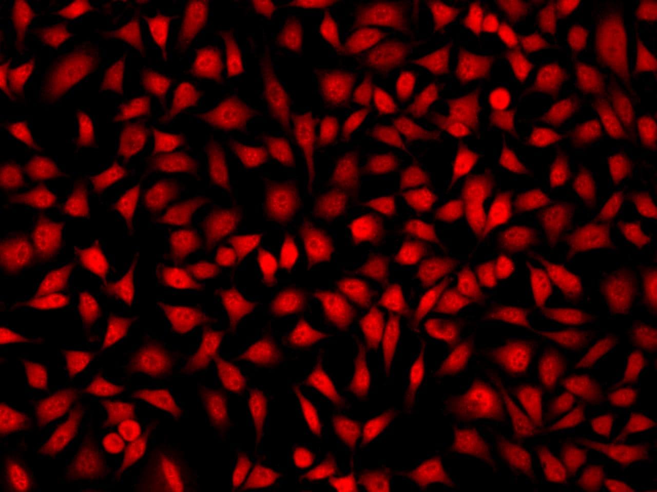 Polyclonal Rabbit anti-Human CSNK1E / CK1 Epsilon Antibody (IF)