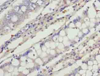 C1orf101 Antibody