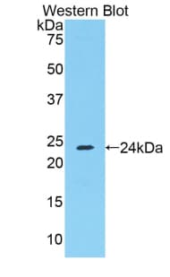 FGA / Fibrinogen Alpha Antibody (aa357-556)