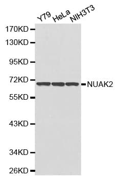 SNARK / NUAK2 Antibody