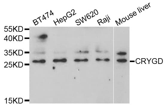 CRYGD / CCP Antibody