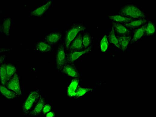 JAG1 / Jagged 1 Antibody