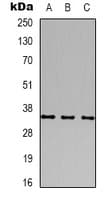 Polyclonal Rabbit anti-Human CACNG2 / Stargazin Antibody (IHC, WB)
