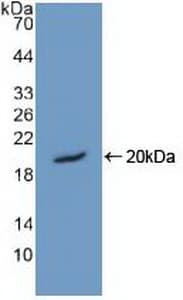 HMGN1 / HMG14 Antibody (aa14-100, Biotin)