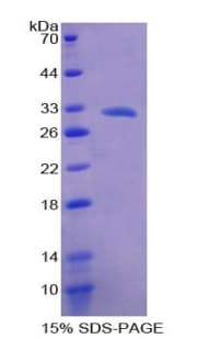 Human ALOX15B / 15-LOX-2 Protein (Recombinant His-T7)