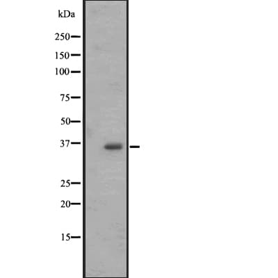 OR2M4 Antibody