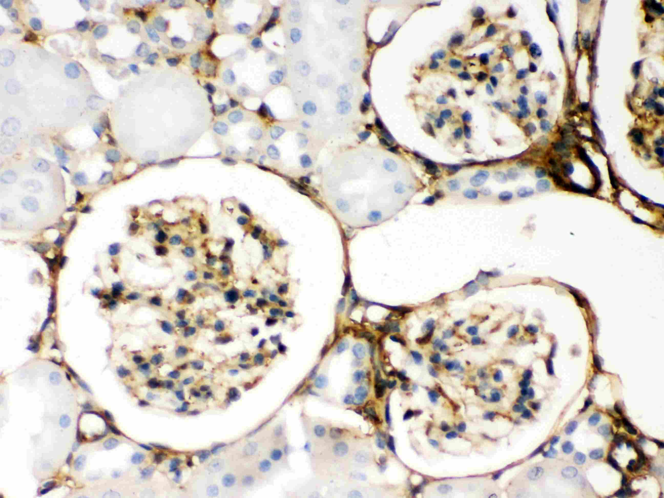 LGALS1 / Galectin 1 Antibody