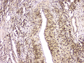 HECTD3 Antibody
