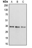 Polyclonal Rabbit anti-Human APOL2 / Apolipoprotein L 2 Antibody (Internal, IHC, IF, WB)