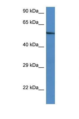 ZBTB43 Antibody (C-Terminus)
