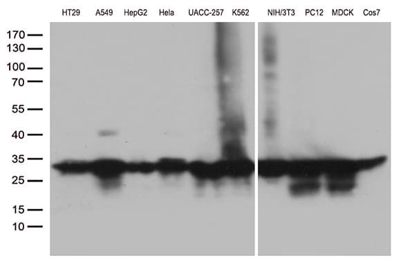 SDHB Antibody (clone OTI2A3)