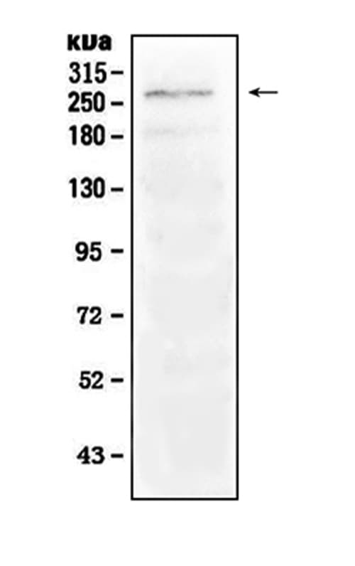 Polyclonal Rabbit anti-Human NOTCH1 Antibody (WB)