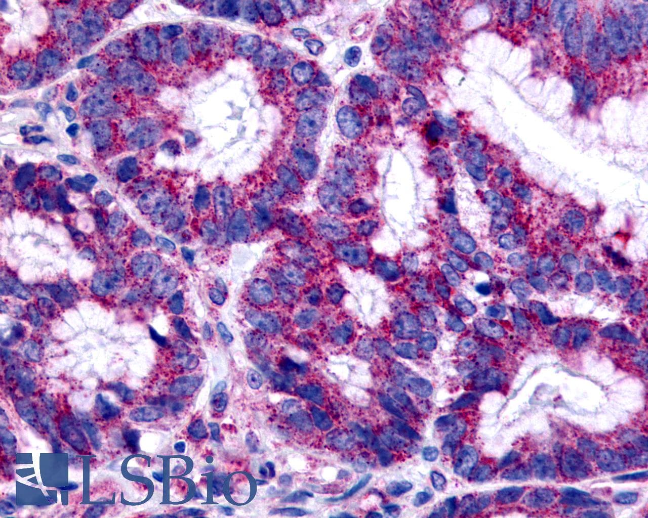 PathPlus™ Polyclonal Rabbit anti-Human GPER1 / GPR30 Antibody (Cytoplasmic Domain, IHC, IF, WB)
