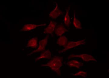 Polyclonal Rabbit anti-Human FGFR1 / FGF Receptor 1 Antibody (phospho-Tyr154, IF, WB)