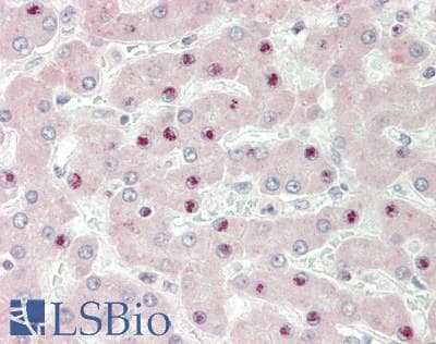 IHC-plus™ ERCC3 / XPB Antibody