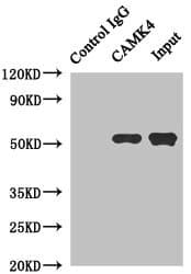 Polyclonal Rabbit anti-Human CAMK4 / CaMK IV Antibody (aa304-473, WB)
