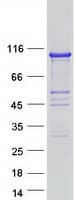 Human ITPKC Protein (Recombinant Myc-DDK (Flag))